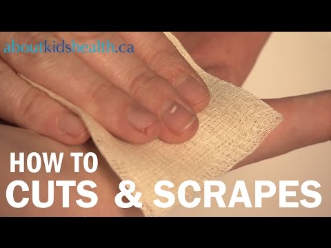 How to treat cuts and scrapes / Comment traiter les...