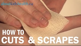 How to treat cuts and scrapes / Comment traiter les coupures et les éraflures