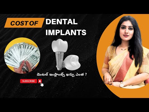 Watch: Dental Implant Cost Factors Explained