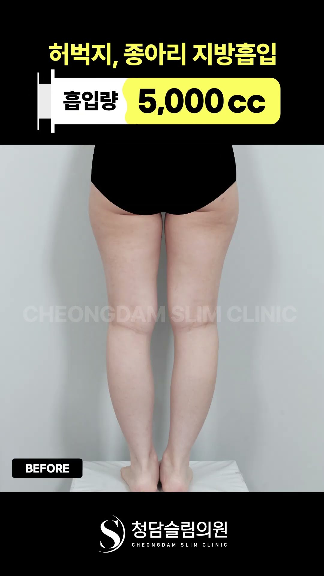 다리선이 이렇게 달라진다고?