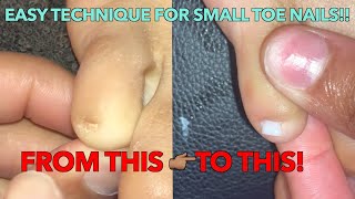 ACRYLIC TOES! | SMALL PINKY NAILS TUTORIAL