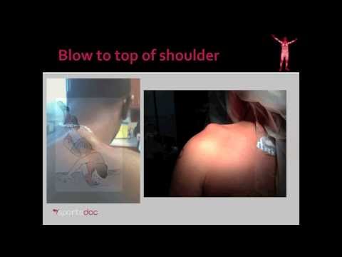Shoulder Separation: AC Dislocation