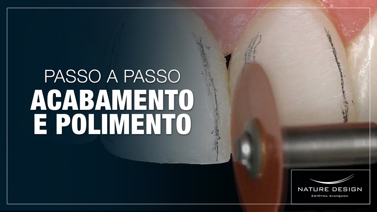 Watch Now Acabamento e Polimento - Passo a Passo | Leonardo Muniz Acabamento e Polimento - Passo a Passo | Leonardo Muniz
