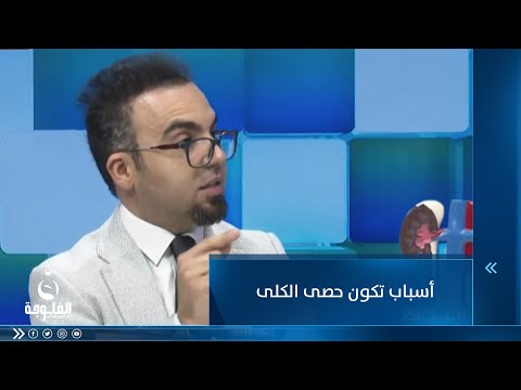 شاهد بالفيديو.. أسباب تكون حصى الكلى