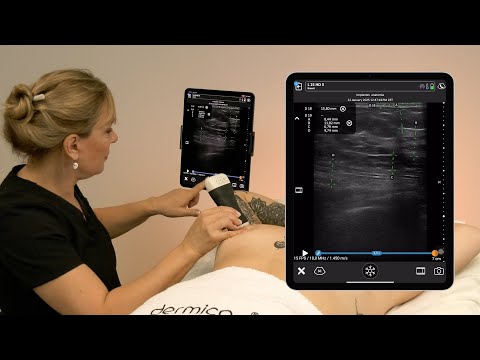 Pre Surgical Breast Ultrasound Anatomy Assessment