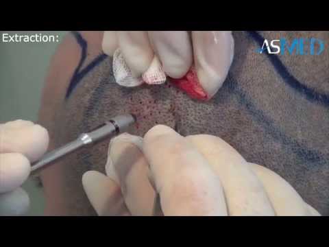 download lagu mp3 mp4 Asmed Turkey, download lagu Asmed Turkey gratis, unduh video klip Download Asmed Turkey Mp3 dan Mp4 Full Gratis