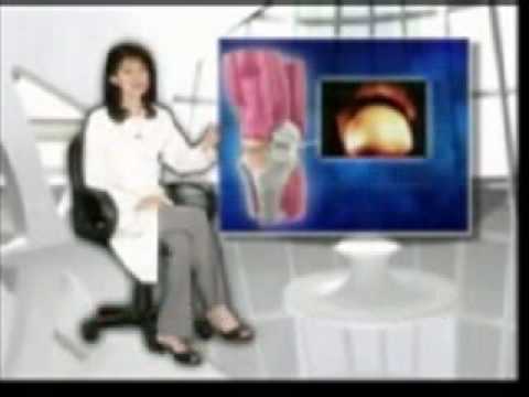 Malfunction of Immune System (Autoimmune diseases)