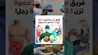قد تكون الأكبر تاريخيا.. فريق طبي ينجح في استخراج حصوة تزن 3.1 كلغ من مثانة رجل! thumbnail