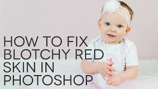 How to Fix Blotchy Red Skin in Photoshop