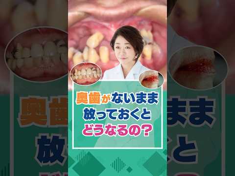 奥歯がないまま放っておくとどうなるの？