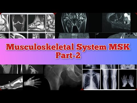 Radiology Viva Cases # 74-77 | Musculoskeletal System Part-2 | MSK #medical #radiology #ultrasound