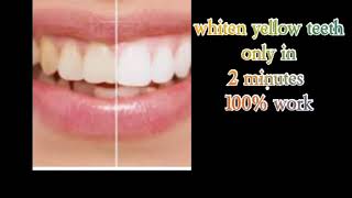Teeth whitening vah bhi sirf 2 minutes mein,100% guaranteed work