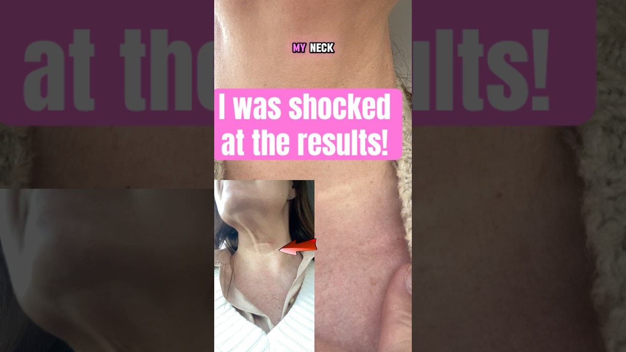 Does this Neck Firming Serum Actually Work???