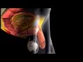 Erection And Ejaculation 3D Medical Animation ABP