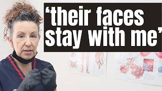 A most upsetting case in the mortuary