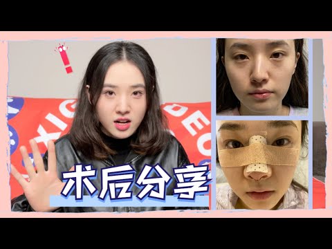 歪鼻矯正