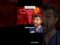 Abortions Are Never Medically Necessary Wait