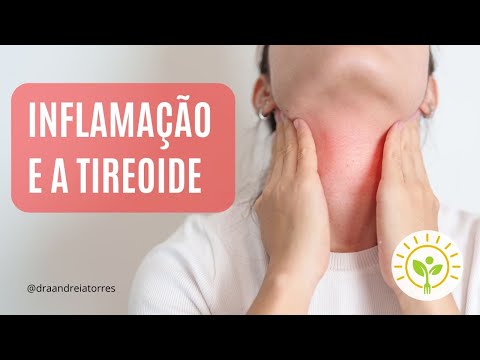 Suplementação para melhoria da tireoide &mdash; ANDREIA TORRES