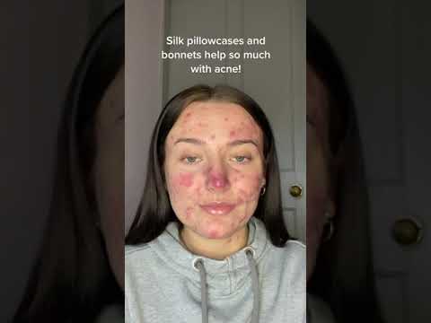 Silk pillowcase is best for acne? #shorts