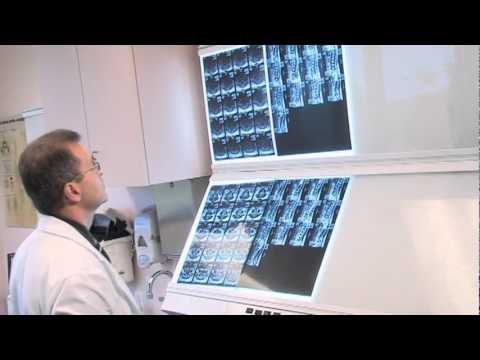 Back Pain Treatments