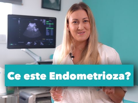 Endometrioza: Simptome, Diagnostic și Tratament | Dr. Oana Solomon
