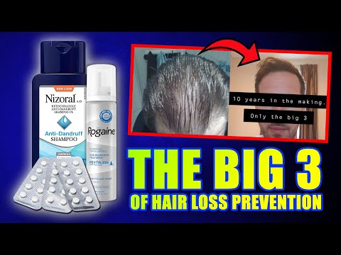 "The Big 3" Hair Loss Prevention Protocol Before And After 10 YEARS LATER
