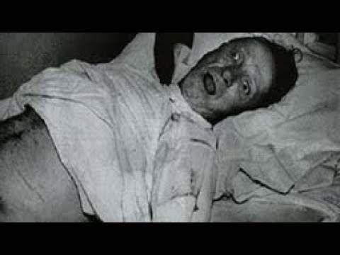 The Most Disturbing RABIES Case Ever Recorded (Unsolved Mysteries #5)