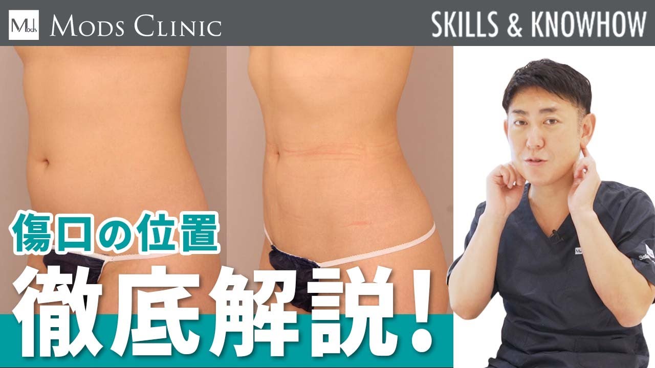 「電車で帰ります！」施術直後から普通に身体が動く！