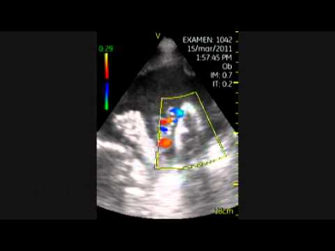 Pocket-Sized Ultrasound Gestation Inspection
