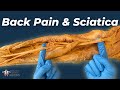 The Worst Kind of Back Pain | Herniated Discs & Sciatica