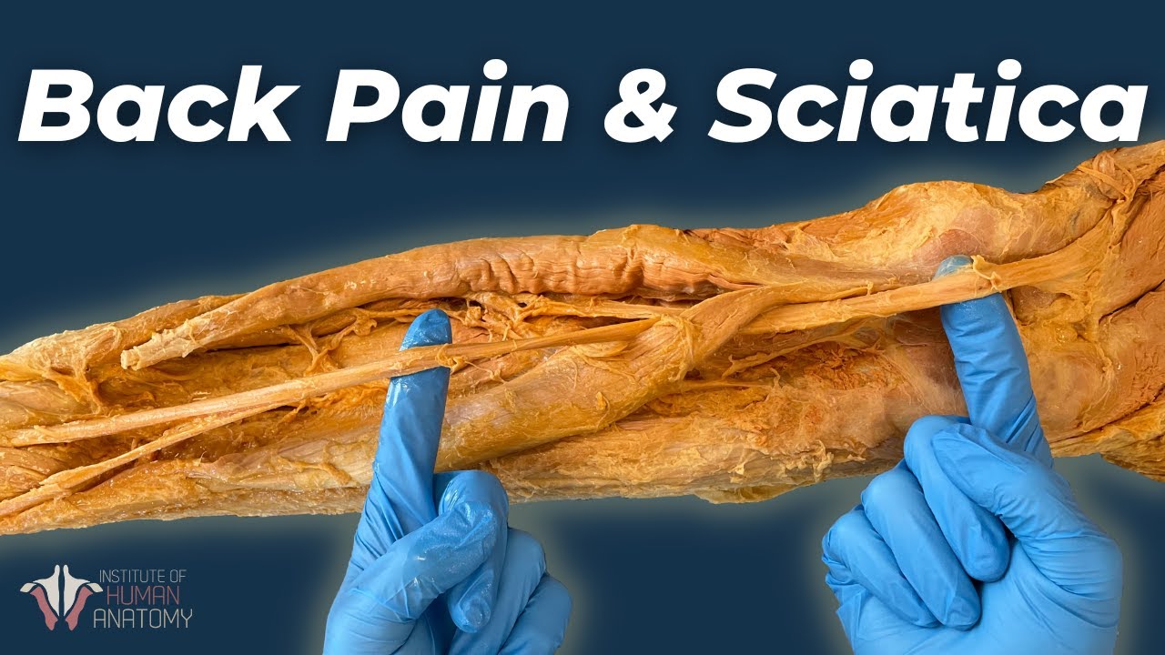 The Worst Kind of Back Pain | Herniated Discs & Sciatica