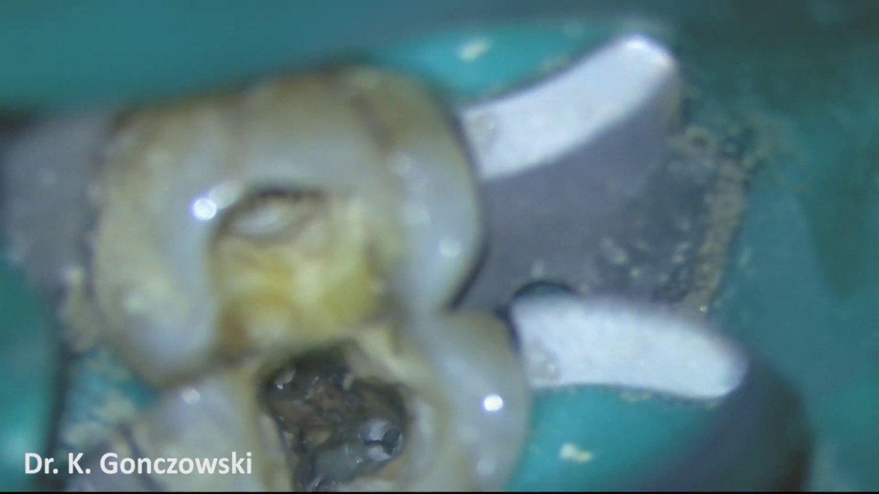 Krzysztof Gończowski-42