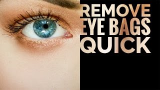 Easiest Way to Remove Bags from Under the Eyes and Dark Circles in Photoshop