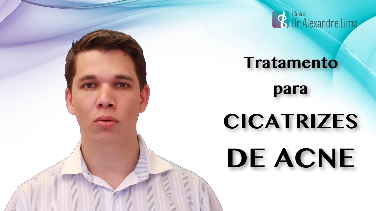 Como é o  Tratamento para Cicatrizes de Acne com Laser de CO2 Fracionado