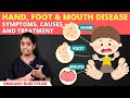 வீடியோக்கள் 18 Video thumbnail