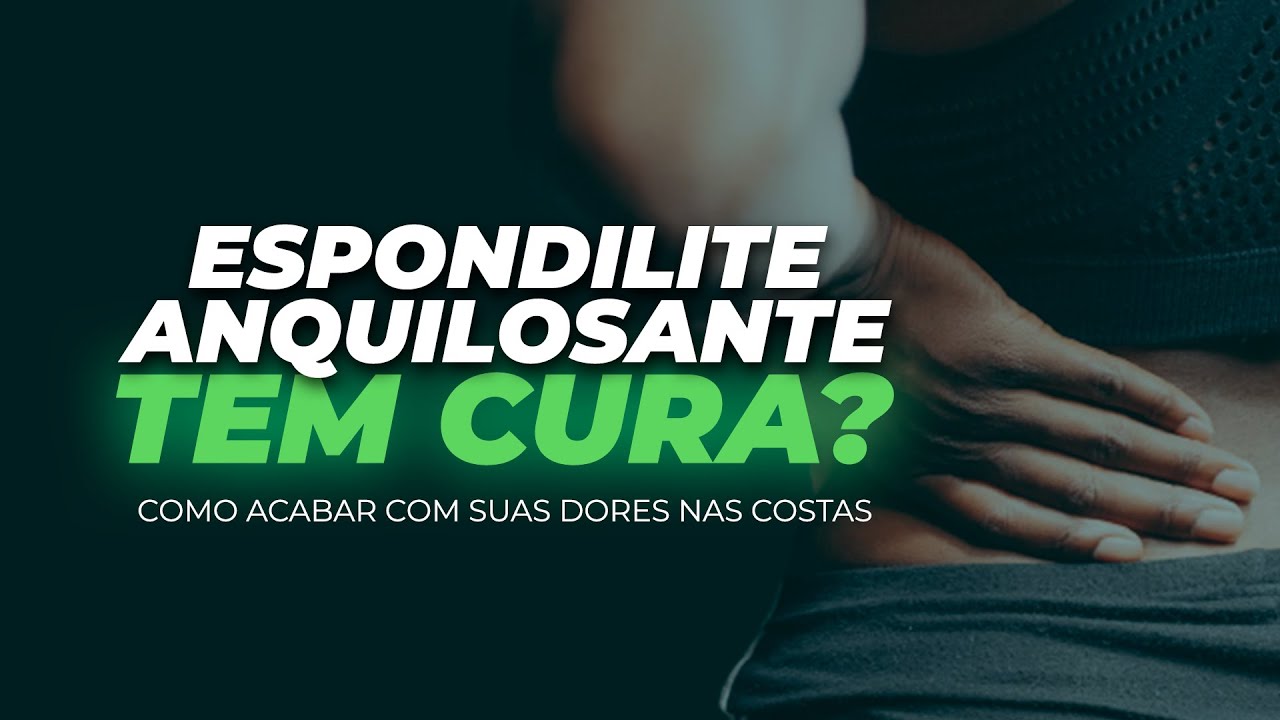 ESPONDILITE ANQUILOSANTE: um NOVO jeito de entender e resolver.