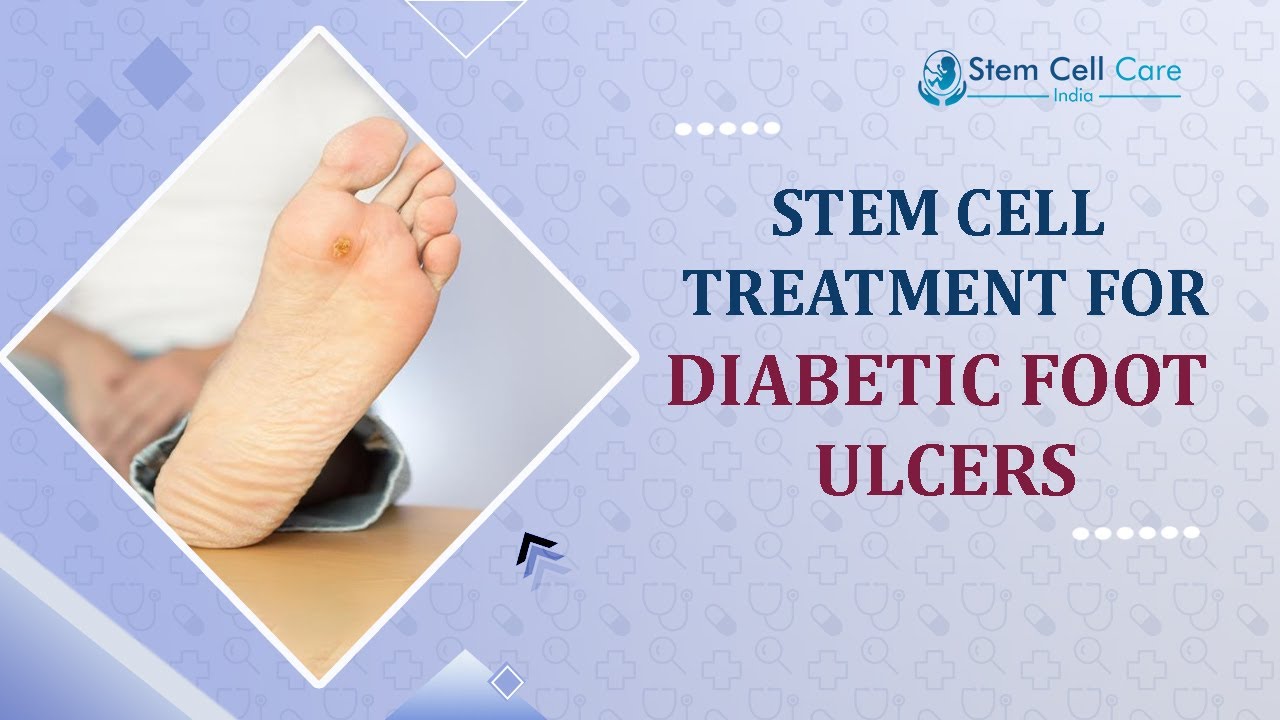 Diabetic Foot Ulcers | Stem Cell Care India | Best Stem Cell Center For Diabetic Foot Ulcers