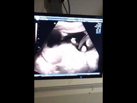 Lea och Theos lillebror