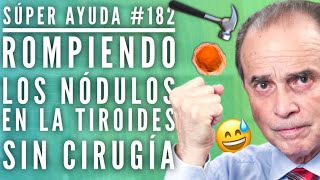 SÚPER AYUDA #182 Rompiendo Los Nódulos En La Tiroides Sin Cirugía