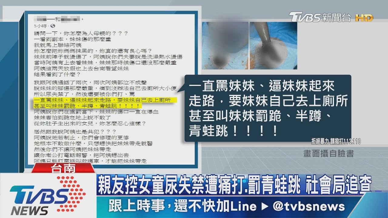 家屬控女童遭痛打、罰青蛙跳　社會局急安置