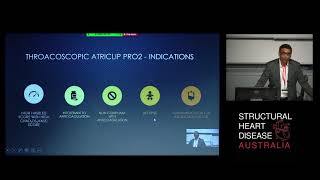 Thoracoscopic Left Atrial Appendage Occlusion: An Alternative Approach – Dr Pragnesh Joshi
