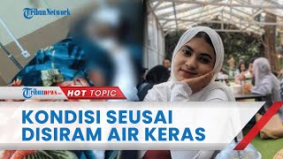 Kondisi Sarah Sesa seusai Disiram Air Keras oleh Suami WNA, Penuh Luka Bakar dan Menjerit Kesakitan