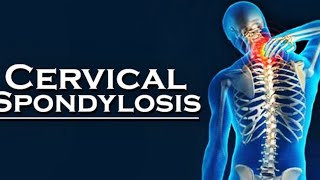 क्या आपको गर्दन में दर्द है ?|| How to cure cervical spondylosis #trending #neck #pain  #relief