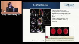 Download Lagu State-of-the-Art Cardio-Oncology Review (Barry Trachtenberg, MD) Thumbnail