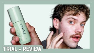 prequel redness reform soothing serum | trial + review