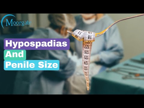 Hypospadias | Hypospadias and Penile size