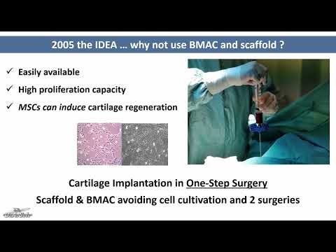 Sciarretta F. - Treatment Methodology to Achieve Better Results - One Step Cartilage Transplantation with HA-BMAC