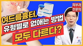 여드름흉터 패인흉터 모공 없애는 법 feat. 큐어젯 쥬베룩 실펌엑스 인라이튼 피코프락셀