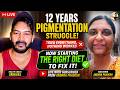 I Was Suffering From Pigmentation Since 12 Years Now I Have Found The Real Solution