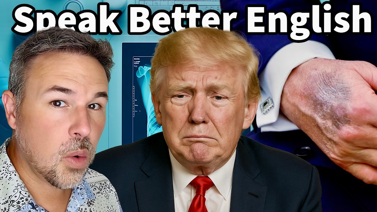 President Trump's Hand Bruising Explained Amid Health Speculation